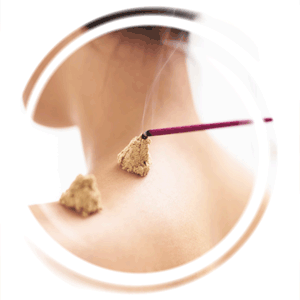 Moxibustion, Dr. med. vet. Karola Lahrmann, Heilpraktikerin, Berlin-Charlottenburg